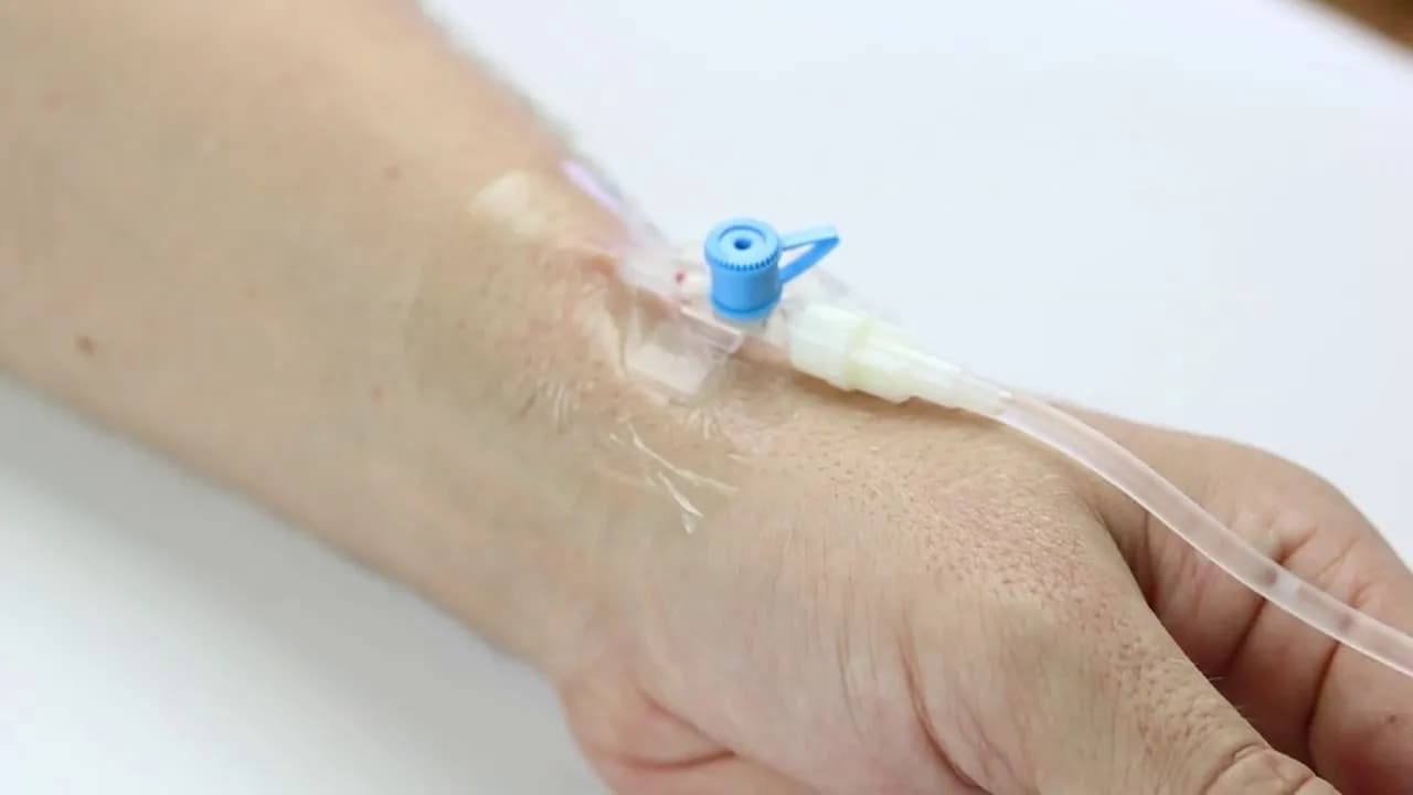 Jak podłączyć kroplówkę do wenflonu bez ryzyka komplikacji? Jak podłączyć kroplówkę do wenflonu bez ryzyka komplikacji?