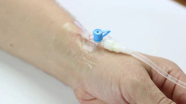 Jak podłączyć kroplówkę do wenflonu bez ryzyka komplikacji? Jak podłączyć kroplówkę do wenflonu bez ryzyka komplikacji?